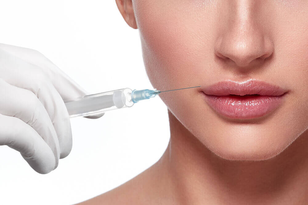 Juvederm Filler