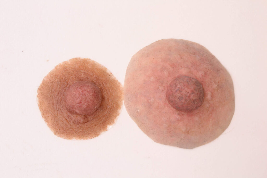 Custom Nipple Prosthesis