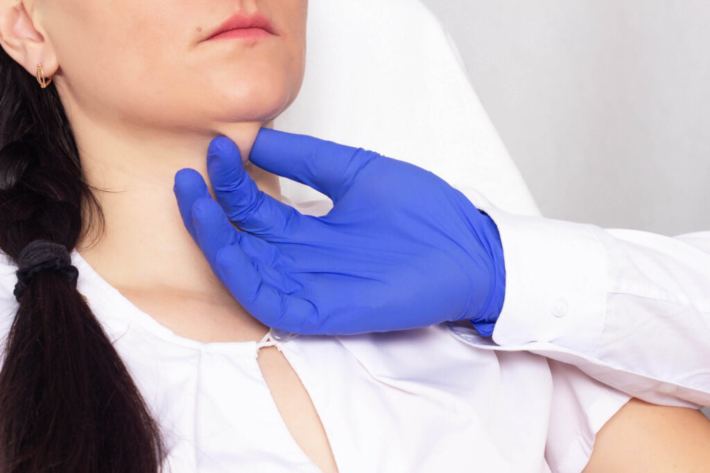 Kybella (Fat dissolving injections) 2