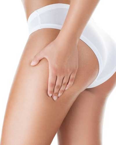 Nonsurgical Butt Lift 2