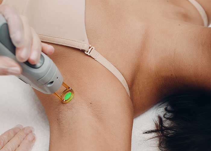 best laser hair removal treatment