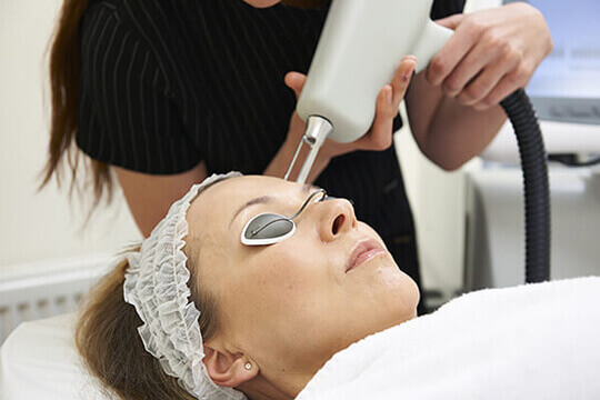 microneedling laser